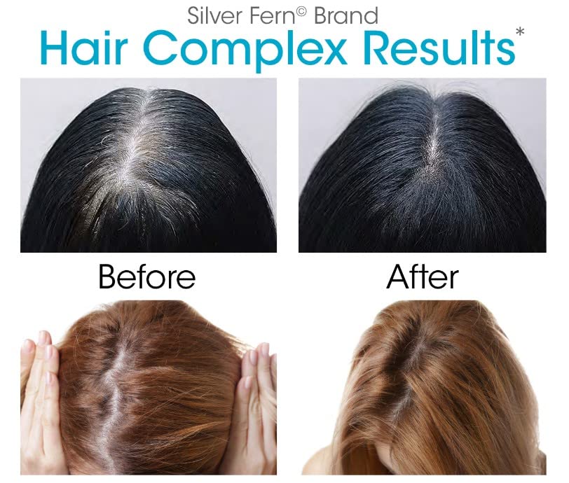 Silver Fern Hair Complex Hair Supplement - Each Bottle Contains a 30-Day Powder Supply - 1 Bottle