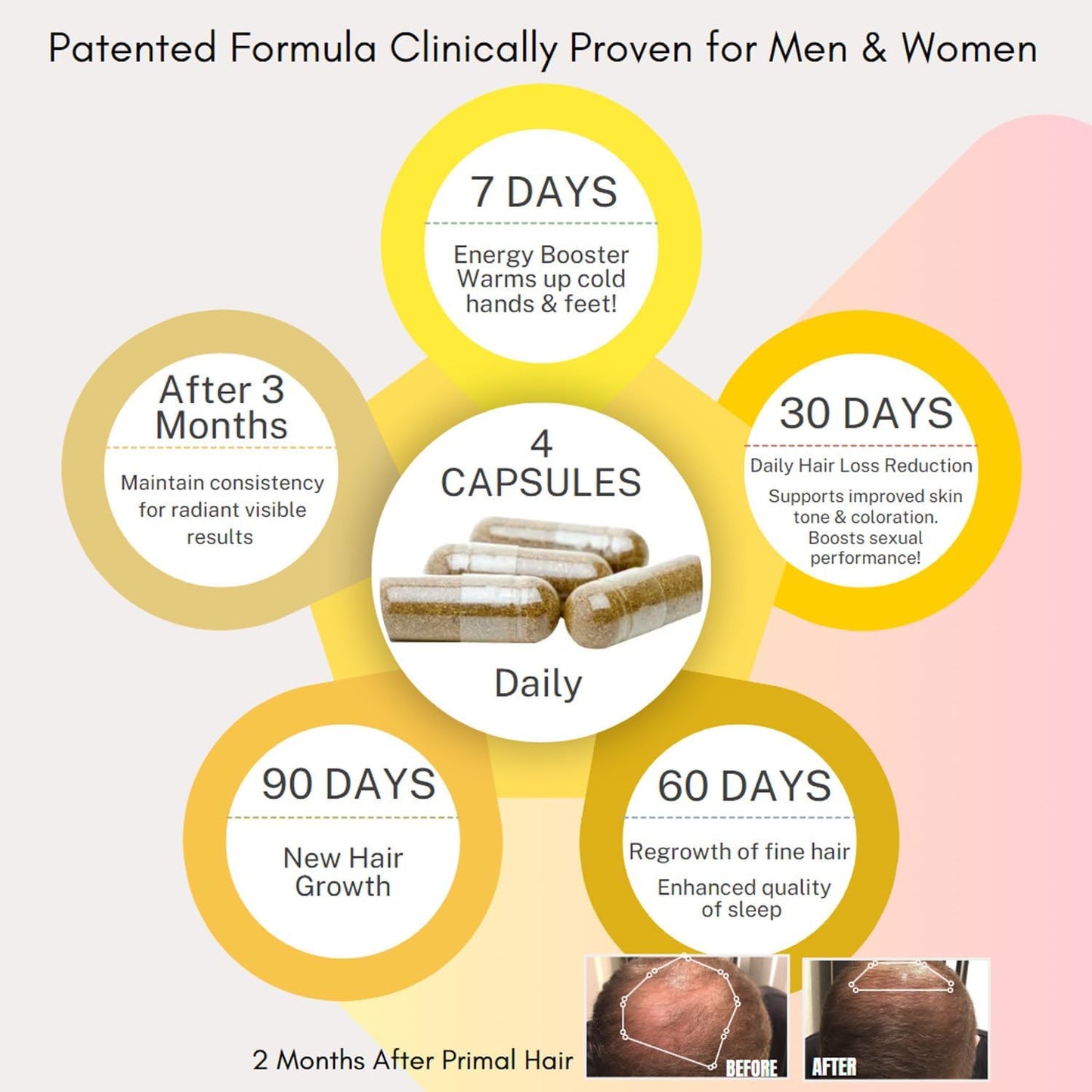 3 PK- 100% Natural Growth Treatment, Reduces Hair Loss, US Patented Formula Proven Effective for Men & Women, 100% Vegan, Non-GMO, 90-Day Supply, 3 Pack