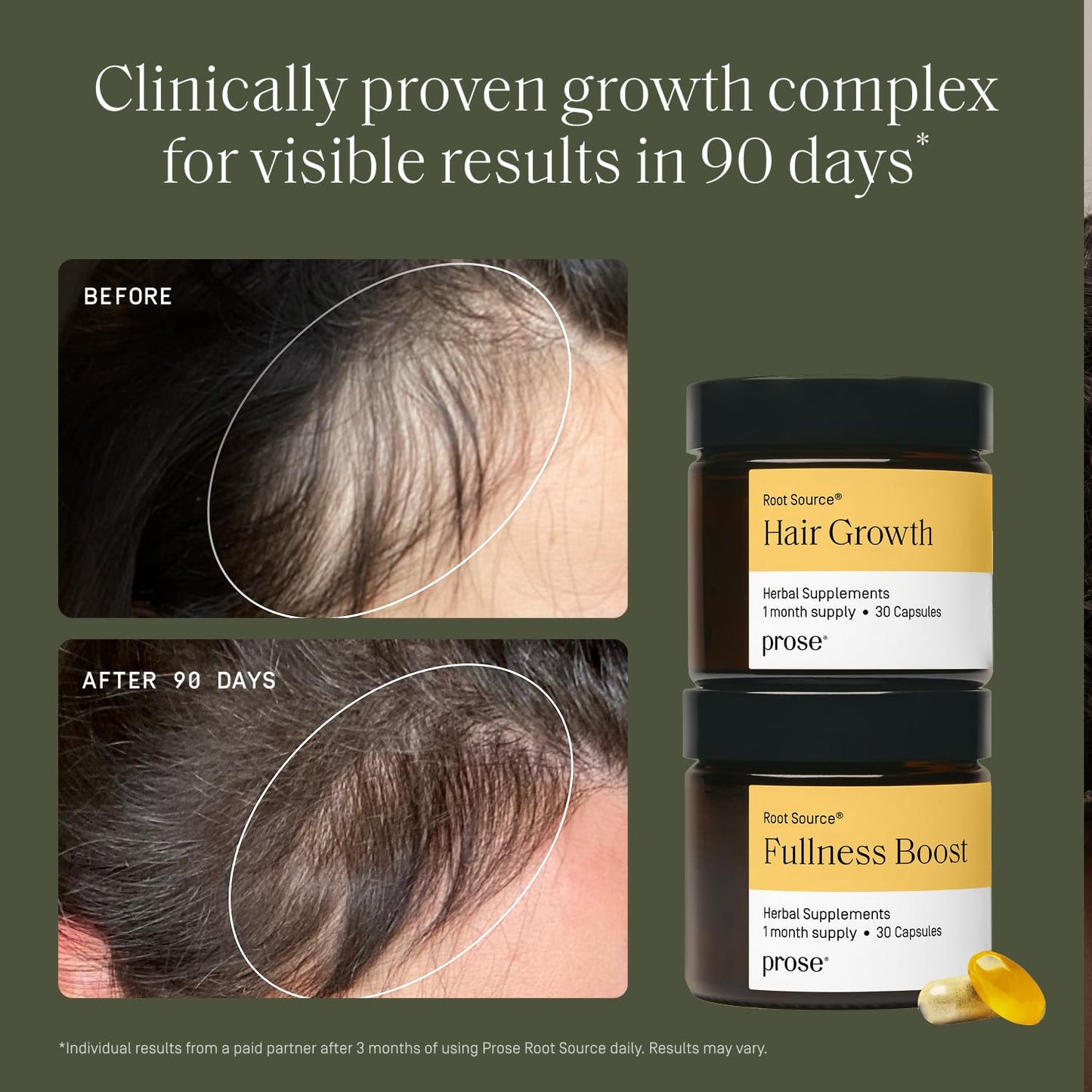 Prose Women’s Age 18-44 Hair Growth & Fullness Boost Supplements, Clinically Proven Growth Complex for Visibly Fuller Hair in 90 Days, Vegan, Biotin, No Hormone Disruptors, Gluten Free, 1 Month Supply