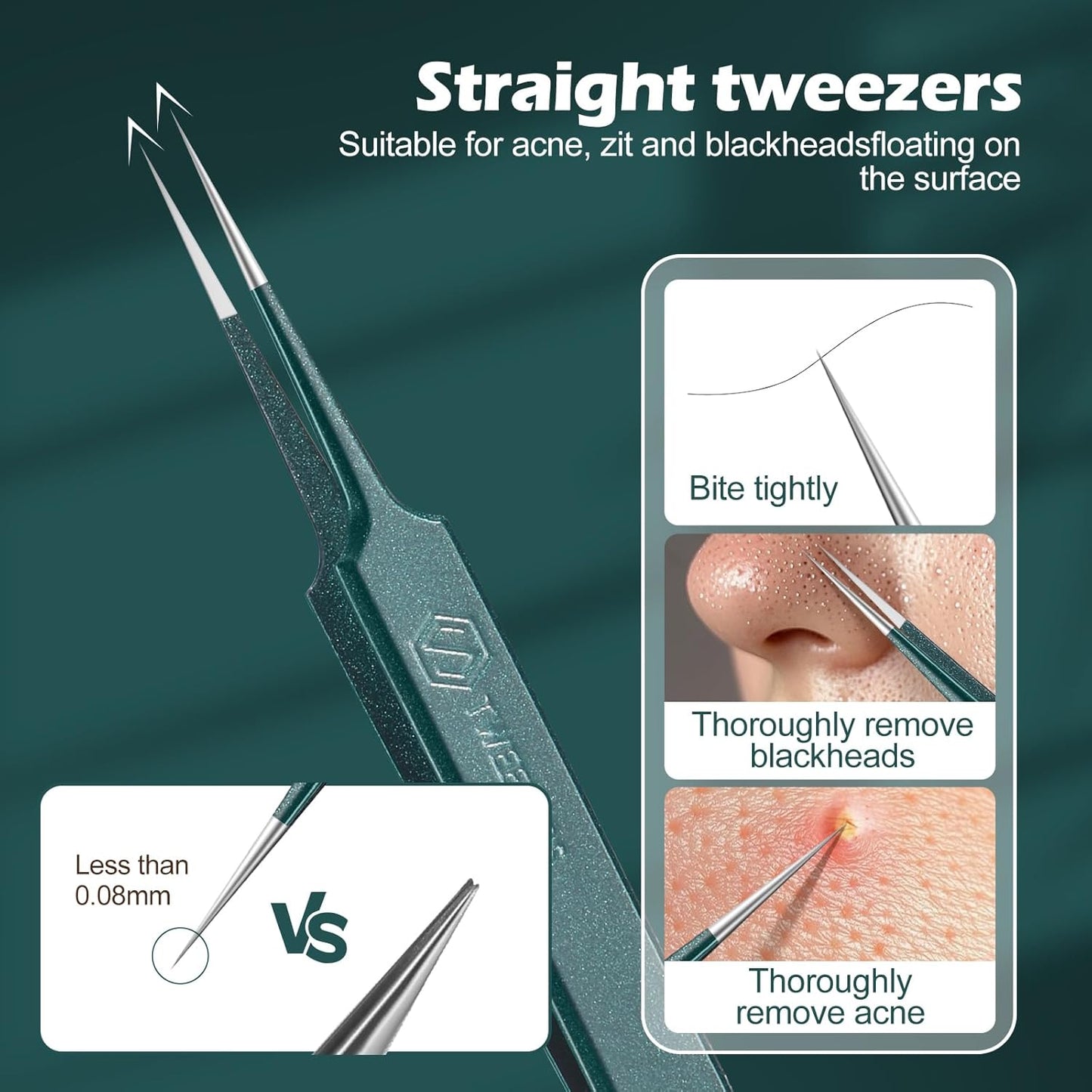 WSYUB Upgrade Professional Facial Blackhead Remover Tweezers, Ingrown Hair Tweezers,Extractor Acne Removal, Pimple Popper Tool,Green