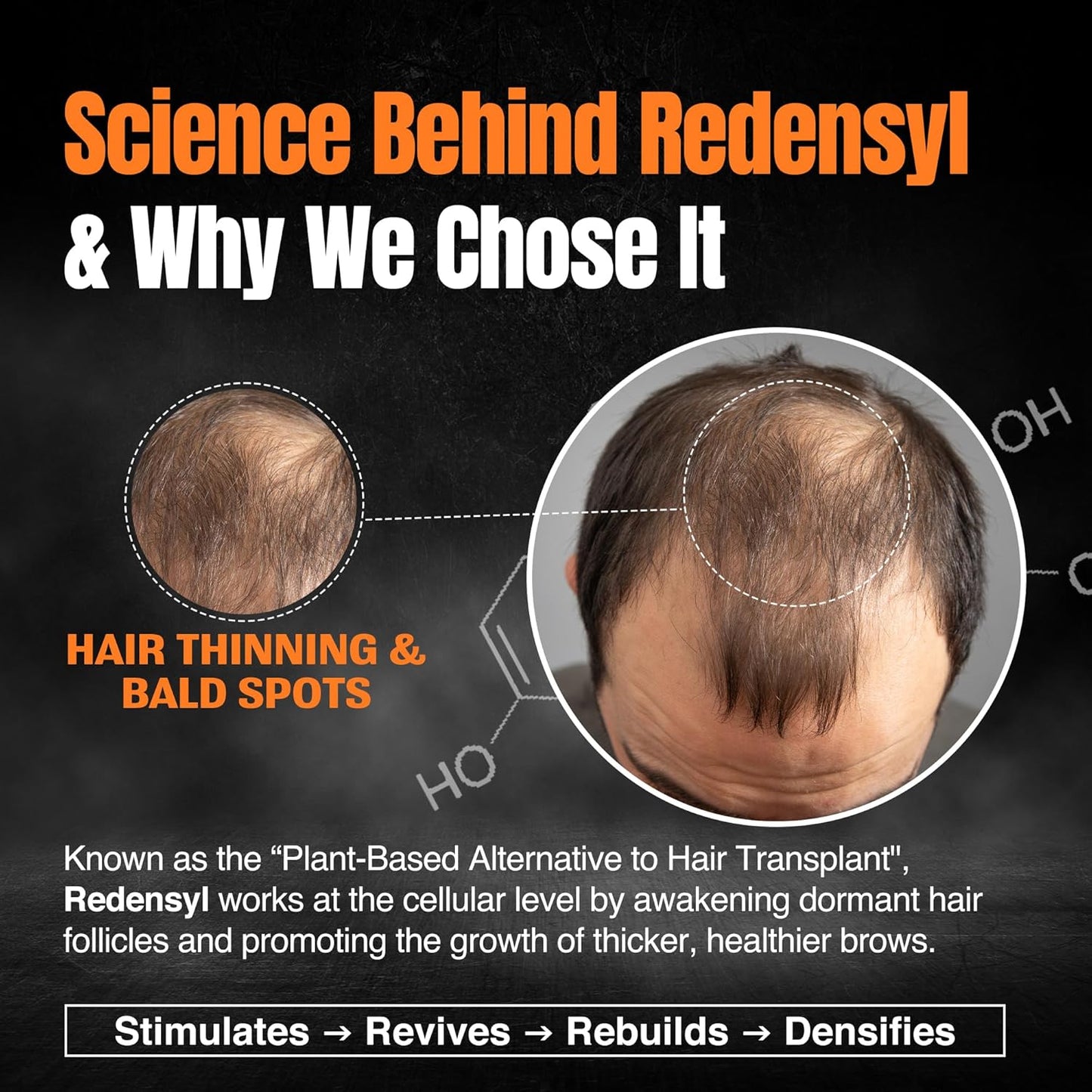 Nourish Mantra Advanced Hair Growth Serum 50ml, 3% Redensyl, 2% Anagain, 2% Procapil, 5% Rice Water, Promotes Hair Regrowth, Anti Thinning & Hair Loss Treatment,Rapid Hair Growth Serum for Women & Men